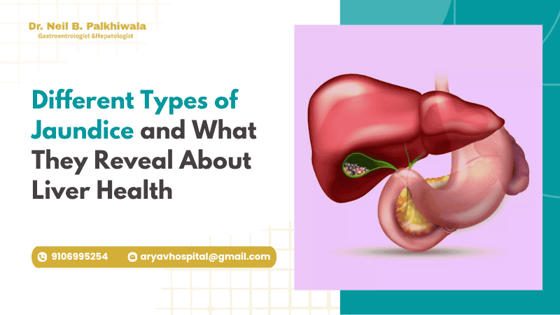 Types Of Jaundice And Liver Health